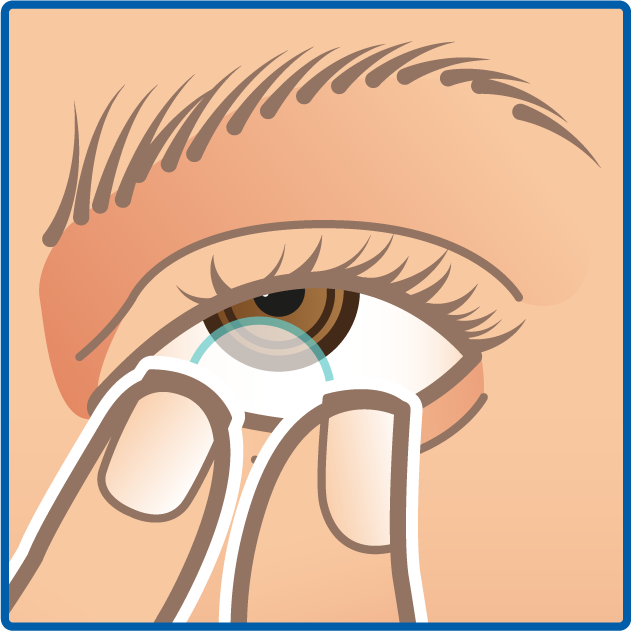 pinch contact lens
